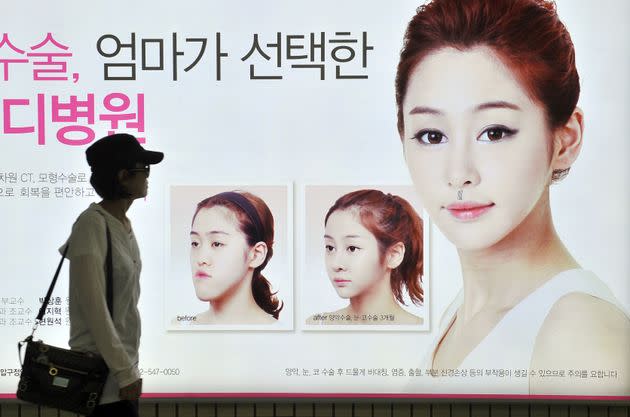 A South Korean woman walks past a street billboard advertising double jaw surgery at a subway station in Seoul, South Korea.