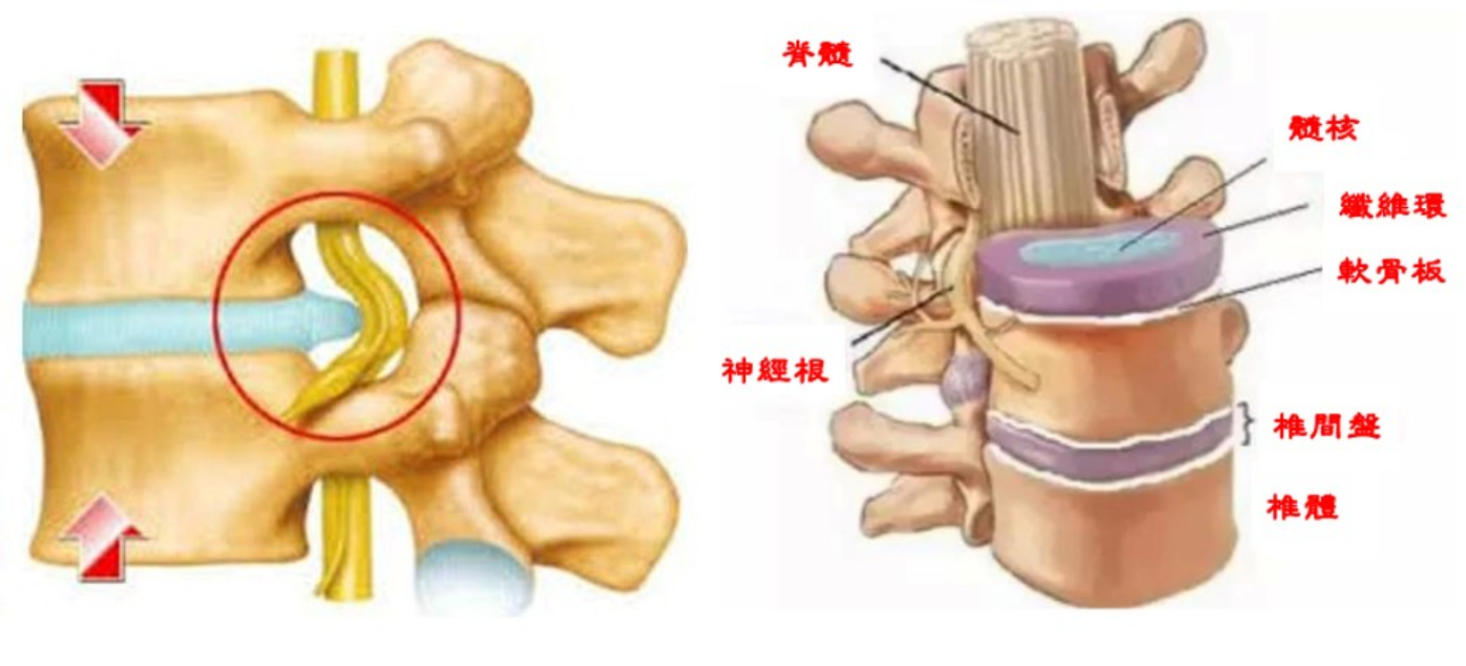 APT療法環椎骨盤調整法 | www.ddechuquisaca.gob.bo