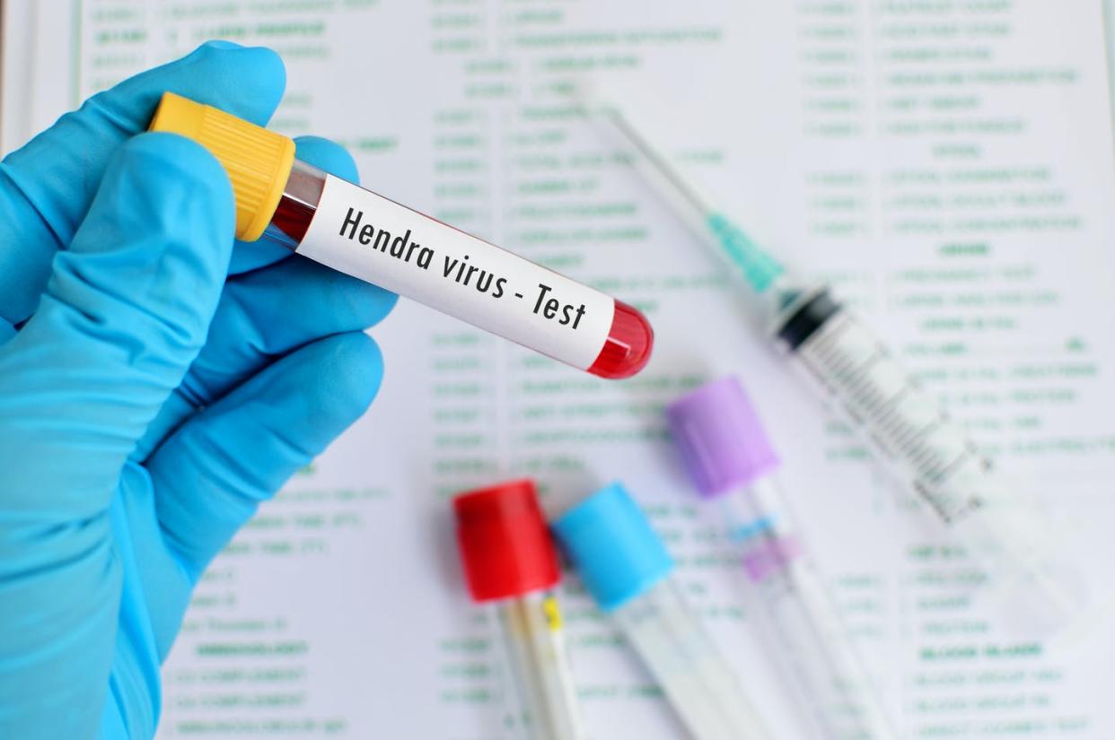   <span class="attribution"><a class="link " href="https://www.shutterstock.com/es/image-photo/test-tube-blood-sample-hendra-virus-437274946" rel="nofollow noopener" target="_blank" data-ylk="slk:Shutterstock / Jarun Ontakrai;elm:context_link;itc:0;sec:content-canvas">Shutterstock / Jarun Ontakrai</a></span>