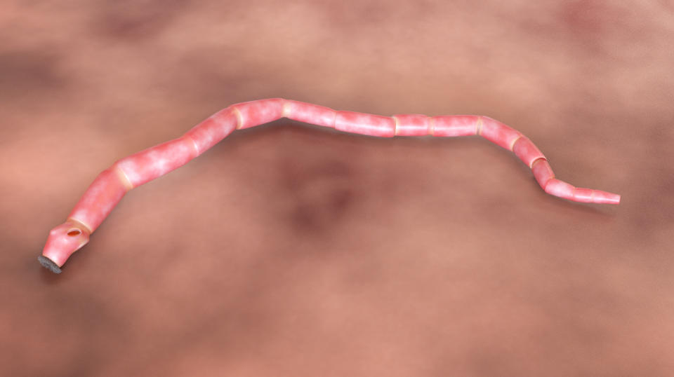 Diagram of a tapeworm in a human intestine. (Photo via Getty Images)