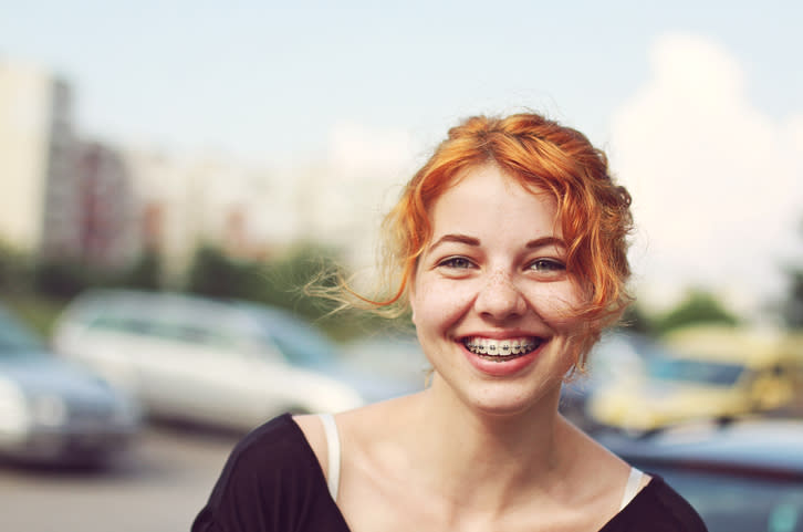 Usar aparatos podría llevarte a tener una mejor sonrisa. – Foto: Alexandra Pavlova/Getty Images