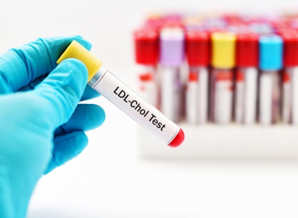 LDL Cholesterol