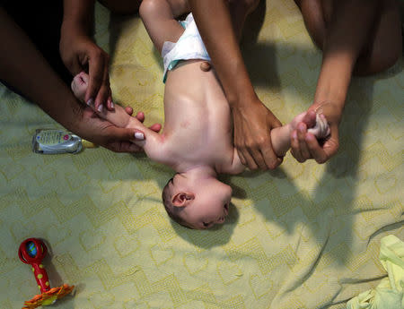 Therapist Rozely Fontoura (L) teaches Daniele Santos Shantala massage on her baby Juan Pedro, who has microcephaly, in Recife, Brazil March 26, 2016. REUTERS/Paulo Whitaker