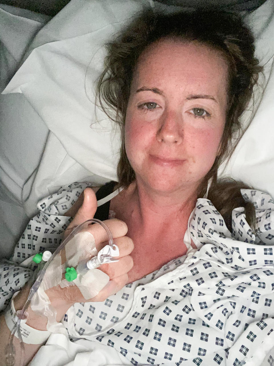 Campbell first started showing symptoms of bowel cancer during her third pregnancy pictured after her surgery. (Image supplied Caters)

