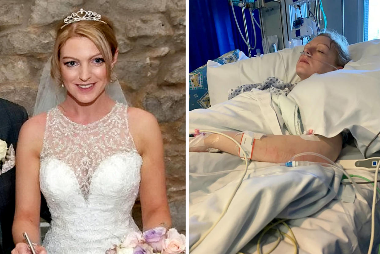 Rachel Pighills, 35, on her wedding day in 2019 and in hospital. (SWNS)