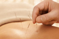 “Anything that helps reduce stress and improves awareness of your body or calms you down is worth trying,” says Paul Nelson, a clinical sexuality educator for Maze Men’s Sexual and Reproductive Health. For some people, acupuncture can help in situations where stress, anxiety, or injury is the cause of ED, Nelson adds.