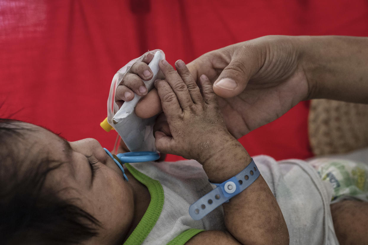 MANILA, PHILIPPINES - MAY 04: Iris Ladrillo tends to her four-month-old son Mark Robin, who is suffering from measles and being treated at a government-run hospital on May 4, 2019 in Manila, Philippines. The Department of Health in the Philippines declared an outbreak of measles early this year, with a total of 31,056 measles cases from January to April 2019, including 415 people who had died from the contagious disease. (Photo by Ezra Acayan/Getty Images)