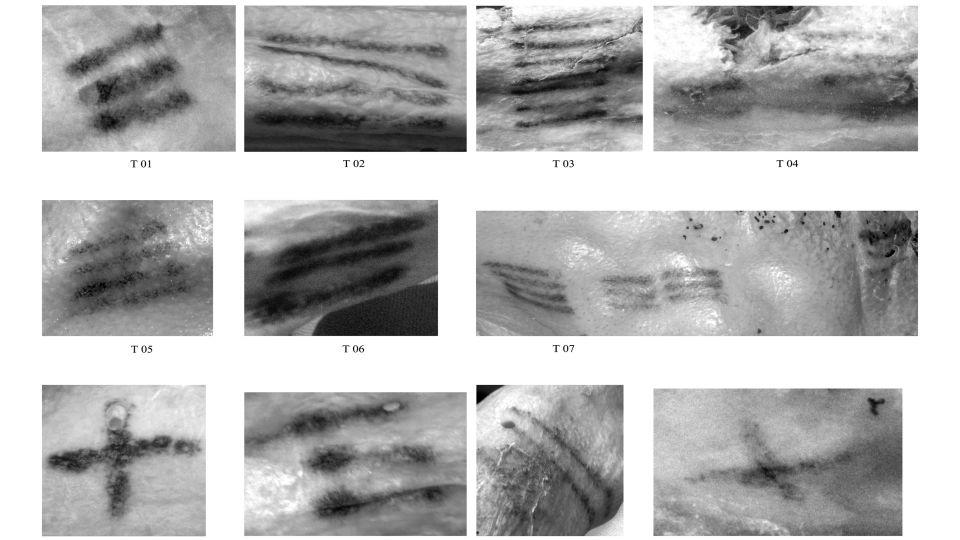 Research shows that Ötzi's tattoos, captured with image processing software, may have been part of an ancient healing technique.  - EURAC Research Institute for Mummy Studies/Marco Samadelli