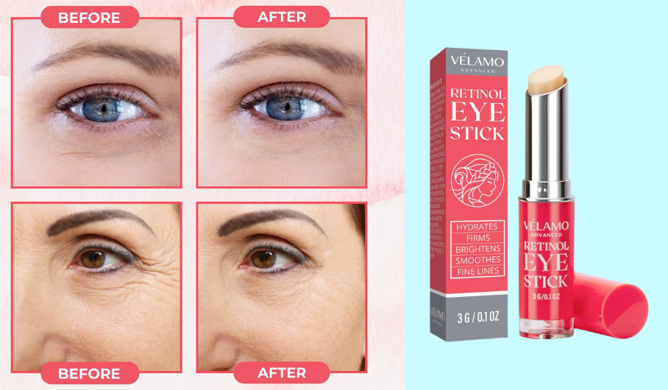 a series of before and after photos and the retinol eye stick