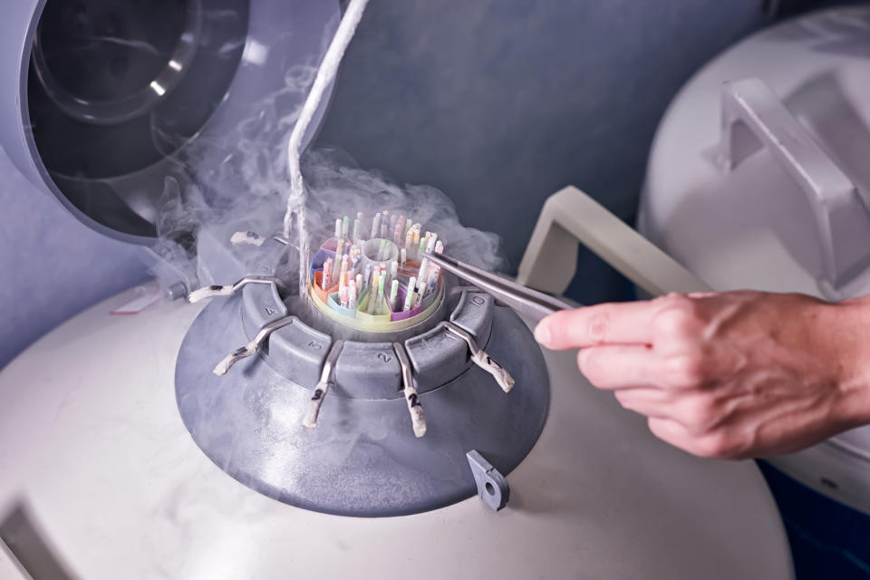 Hand retrieving cryopreserved samples from a liquid nitrogen storage tank