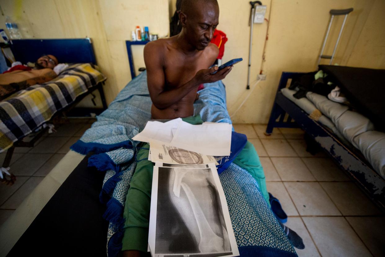 Souare Tidiane, 40, of Guinea, recovers at the Jesus The Good Shepherd Shelter from a femur fracture he sustained soon after he entered Mexico from Guatemala.