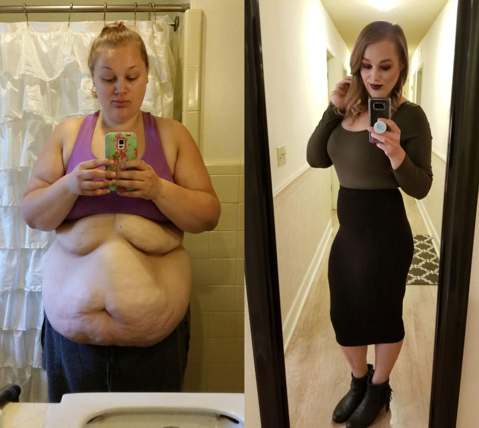 Hannah Legg before and after losing 157 pounds. (Photo courtesy of Hannah Legg)