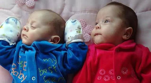 Little Ana Vitoria was born weighing 1.4 kg while her brother Asaph came in at 1.3 kg. Source: Caters News Agency