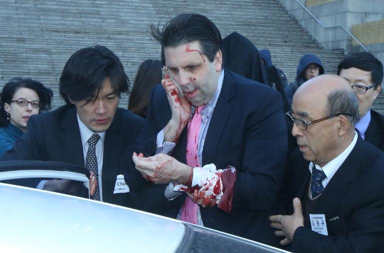 US ambassador to South Korea Mark Lippert (C) covers a wound to his face after he was attacked at the Sejong Cultural Institute in Seoul on March 5, 2015