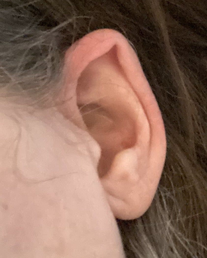 closeup of the ear