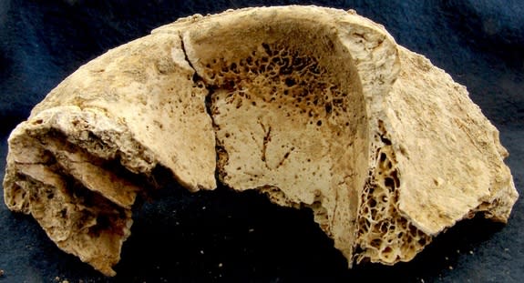 A skull fragment from a teen buried at Rome's Casal Bertone necropolis. The teen ate a millet-heavy diet in childhood but switched to wheat in the years before death. Pores in the bone of the eye socket known as cribra orbitalia suggest the tee