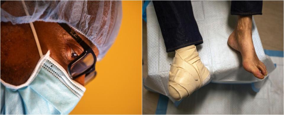 A close-up of Dr. Myron Hall's masked face in the operating room; and a pair of feet: one bear, one heavily bandaged.