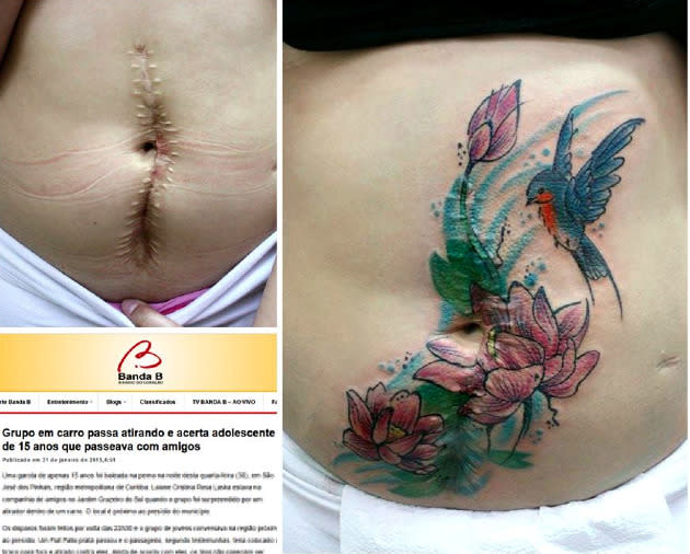 Tattoo Artist Turns Domestic Abuse And Mastectomy Scars Into Something  Beautiful