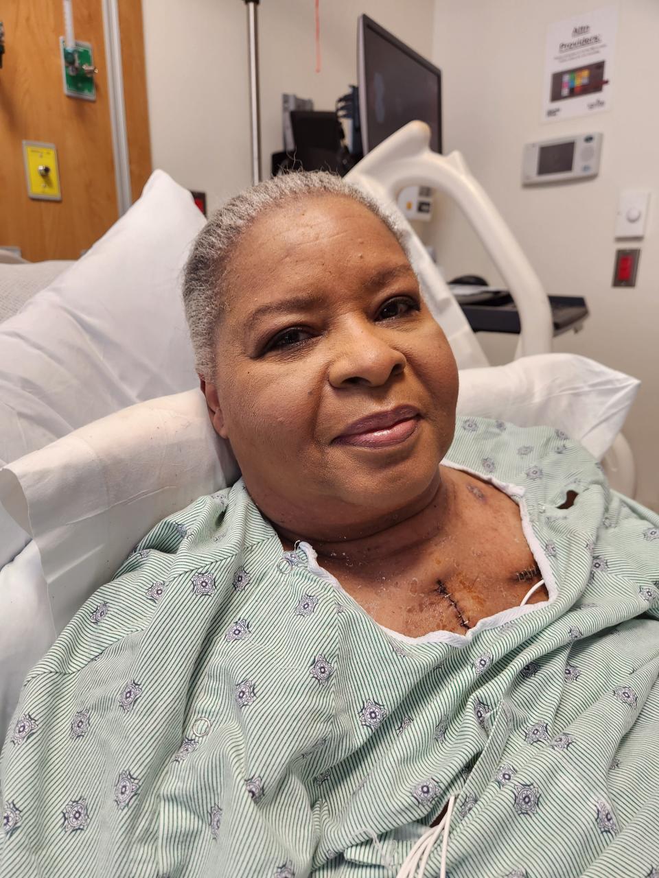 Carolyn McLeod had been waiting 18 years for a heart transplant. Her case was complicated by her medical history and her desire not to have any blood transfusions or blood products before, during or after the procedure.