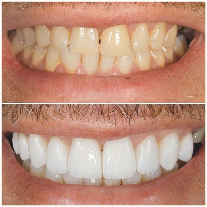 This year, sales manager Paul Rayns got his teeth straightened and whitened, and veneers put on