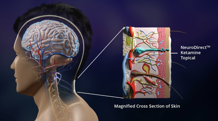 Psycheceutical Bioscience, Inc., Tuesday, April 18, 2023, Press release picture