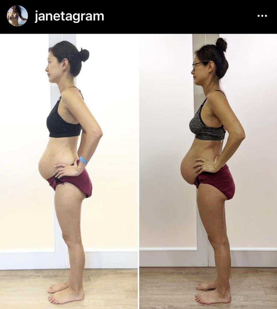 Janet曬出產後身材（右），和4年前（左）生第一胎做比對。（圖／Janet IG）