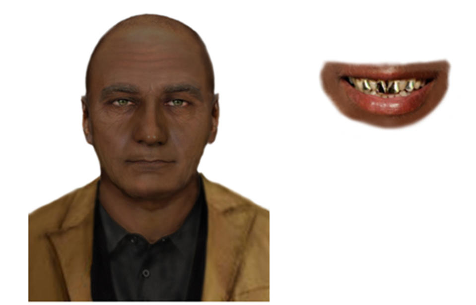 Police have released a composite image of a man they believe can help with their enquiries and the distinctive gold capped teeth of the male suspect. Source: Victoria Police