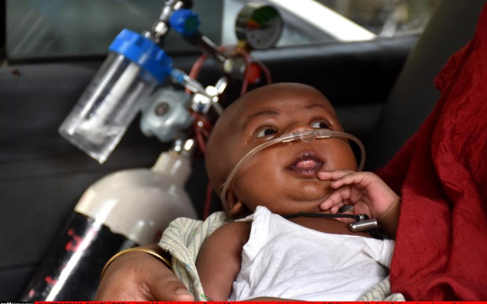 A baby with Covid-19 is seen in a vehicle outside of Chittagong Medical College Hospital as 3rd wave driven by Delta variant spreads across South Asian country with emergence of new hotspots, in Chattogram, Bangladesh on July 11, 2021. - Anadolu