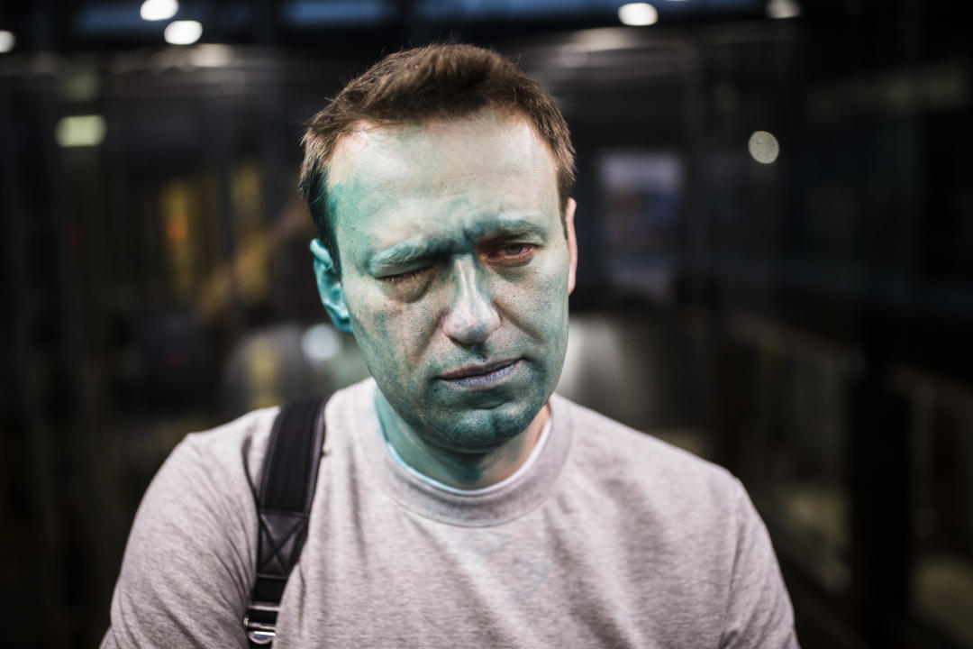 In this photo provided by Alexei Navalny's campaign taken on Thursday, April 27, 2017, Russian opposition leader Alexei Navalny poses for a photo after unknown attackers doused him with green antiseptic outside a conference venue in Moscow, Russia. Navalny, who authored a documentary about the Russian prime minister's alleged corrupt wealth that was viewed more than 20 million times online, was the key force behind nationwide anti-government rallies in March, Russia's largest and most widespread in years. (Evgeny Feldman/Navalny Campaign via AP)