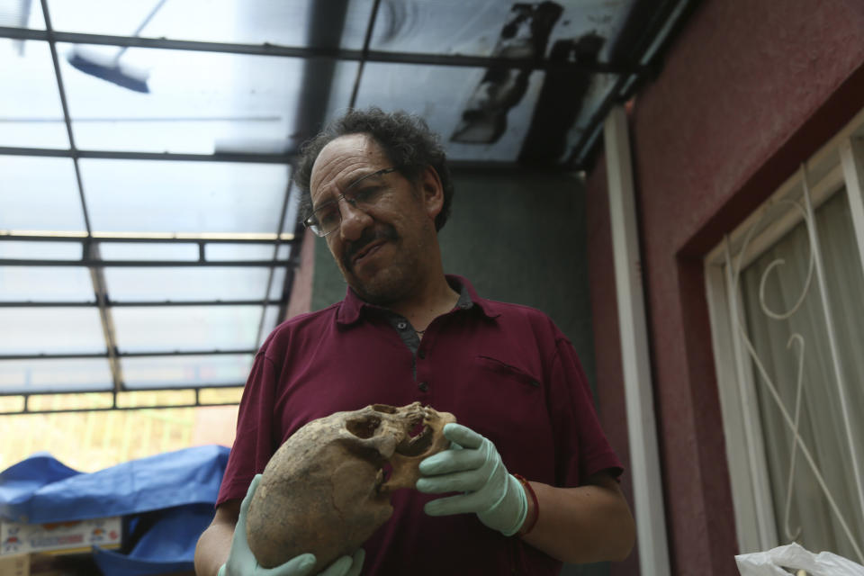 Jedu Sadarnaga shows an elongated skull on Thursday, Nov. 15, 2018 from one of the tombs found at a Bolivian quarry near the capital of La Paz. The tombs contained remains belonging to more than 100 individuals and were buried with more than 30 vessels used by the Incas. (AP Photo/Luis Gandarillas)