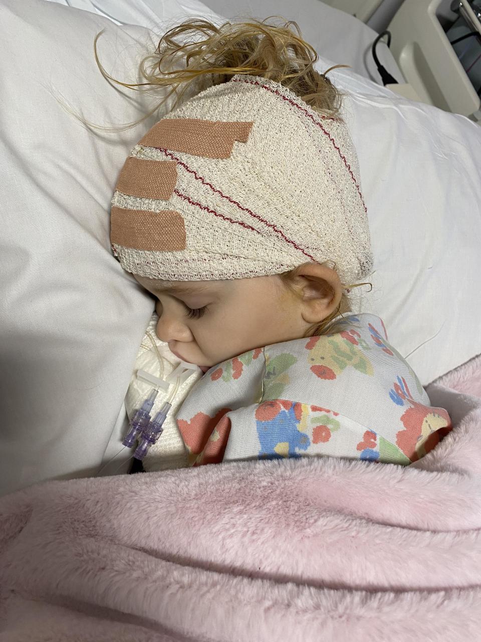 Evie asleep in a hospital bed after shunt surgery.