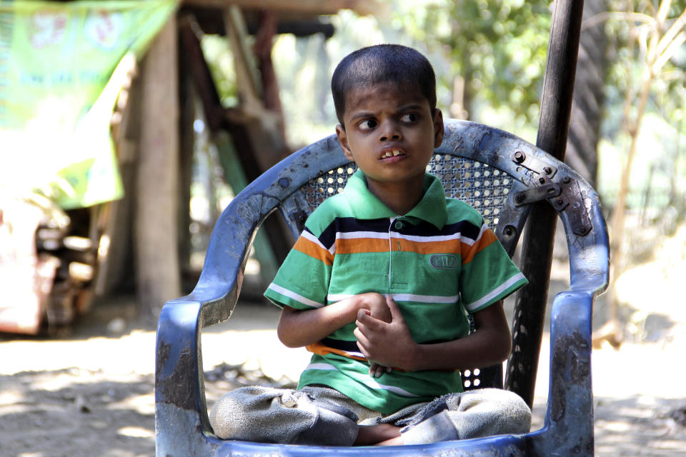 In this Feb. 27, 2014 photo, a 7-year old malnourished ethnic Rohingya boy, Rabi Allarm sits at The' Chaung village, north of Sittwe, Rakhine State, Myanmar. According to a 2011 report by the European Community Humanitarian Office, even before the latest burst of violence erupted in June 2012, acute malnutrition rates in parts of northern Rakhine reached 23 percent, far above the 15 percent emergency level set by the World Health Organization. (AP Photo/Pyae Phyo Thant Zin)