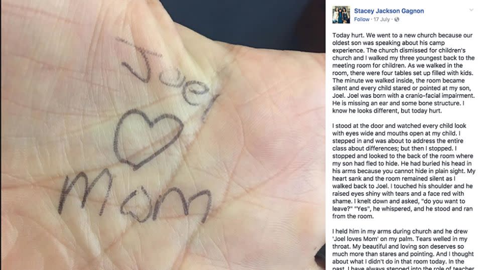 Stacey Gagno's moving Facebook post quickly went viral. Source Facebook