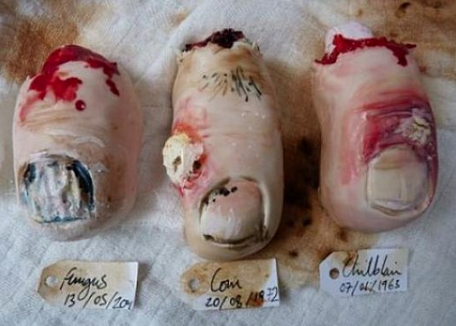 Severed Toe Cakes