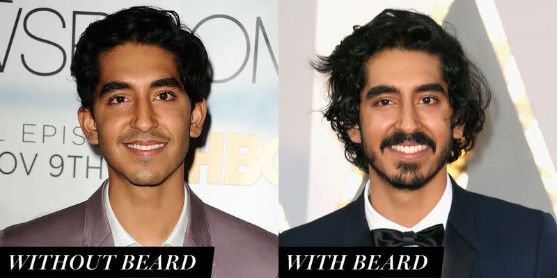 Dev Patel