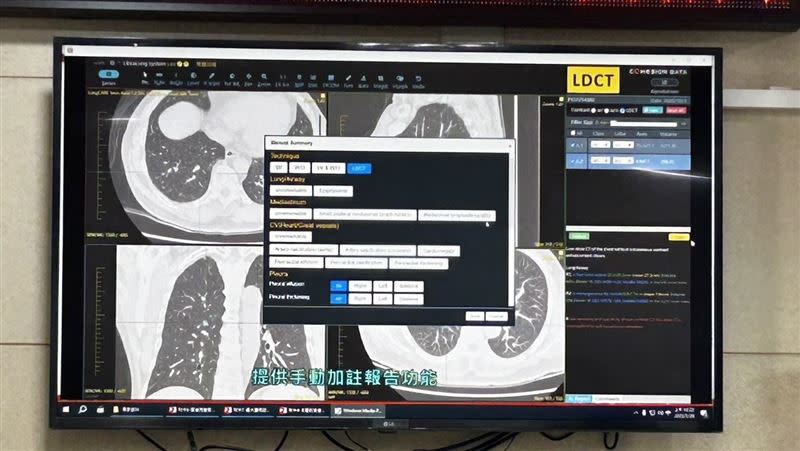 國健署和台灣大學合作開發AI輔助判讀LDCT（圖／記者簡浩正攝影）
