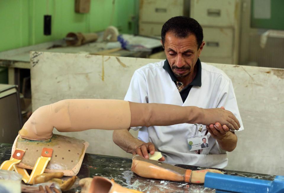 In this March 25, 2014 photo, a man works at a prosthetics hospital in Baghdad, Iraq. As parliamentary elections are held Wednesday, April 30, more than two years after the withdrawal of U.S. troops, Baghdad is once again a city gripped by fear and scarred by violence. (AP Photo/Karim Kadim)