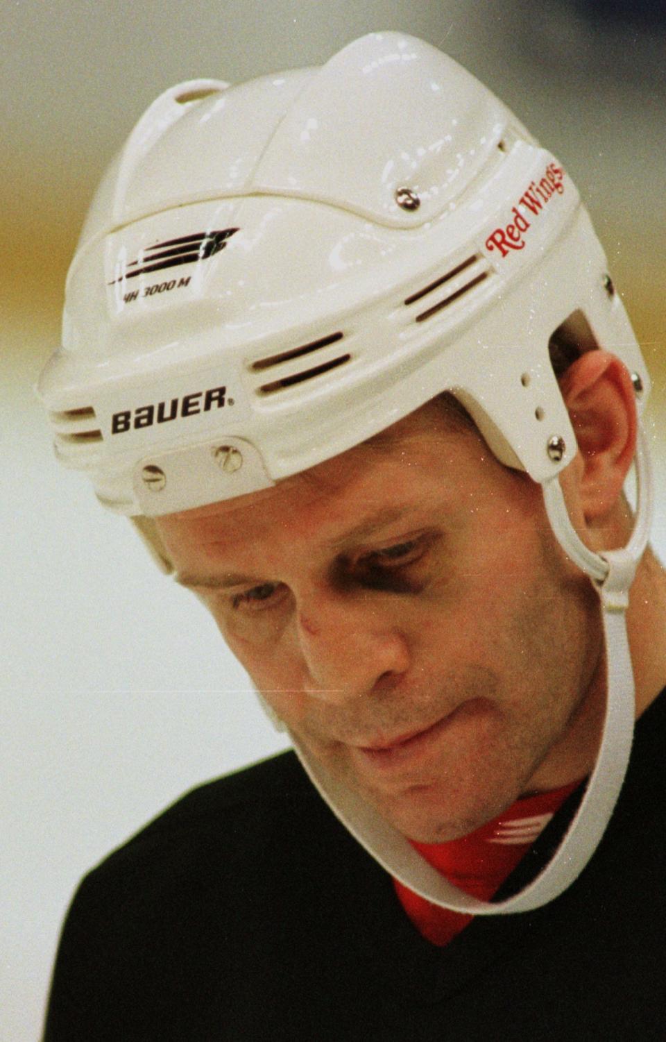 Vladimir Konstantinov shows a black eye during practice, April 24, 1997 in Detroit.