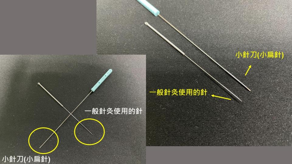 一般針灸使用的針跟小針刀是不一樣的。