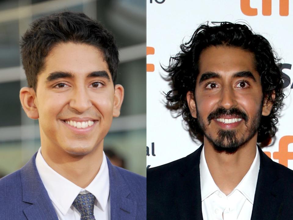 Dev Patel with short hair on the left and long hair on the right