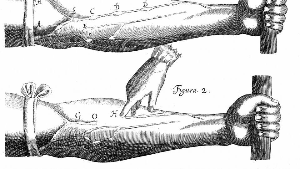 A 17th-century diagram, by English physician William Harvey, illustrating tourniquet and effects on blood circulation. - Photos.com/Getty Images