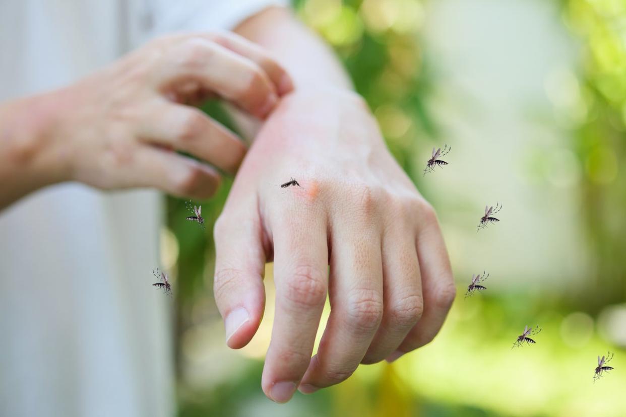 Man itching and scratching on hand from allergy skin rash cause by Mosquitoes bite