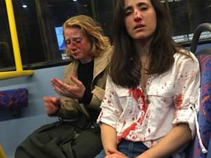 LGBT+ campaigners have warned that homophobic incidents, such as a recent bus attack in which a lesbian couple were left bloodied and hospitalised, are more common than many people realise, as Pride month gets underway. Police have called for witnesses and information after Melania Geymonat, a 28-year-old Ryanair cabin crew member from Uruguay, and her girlfriend Chris, were attacked by four men on a London night bus on 30 May. The men demanded the couple kiss for their entertainment while they threw coins at them. They then beat them up, including punching the women in the face. “This attack won’t be the only hate crime against the LGBT+ community this month,” Laura Russell, director of campaigns, policy and research at Stonewall, told The Independent. For many in the LGBT+ community, harassment and violence is a daily struggle, campaigners said."People don't realise this is something people face every day," Kim Sanders, director of communications at Stonewall told The Independent."People don't hold hands and there's a reason for that; it's because LGBT+ people still face hate crimes. So people are trying to keep themselves safe by trying to go under the radar."Jessica White, community safety lead at the LGBT Foundation, also said attacks often go unreported."[When it comes to this most recent attack] unfortunately there wasn't any element of surprise," she told The Independent. Kseniya Kirichenko, senior officer for women and UN Advocacy at the International Lesbian, Gay, Bisexual, Trans and Intersex Association (ILGA), told The Independent: "This is happening even in places you think would be safe spaces, like London."Campaigners also said many lesbian, bisexual and queer women experience homophobia and misogyny combined. "This [attack] also reveals the sexualization of lesbian women, even the word lesbian is so sexualised and this attack reflects that," Ms Kirichenko said."For lesbian women there is always an added dimension of misogyny thrown in there. It's an assault on you as an LGBT+ person and on you as a woman," Ms Sanders said. In a government report in 2019, at least two in five respondents had experienced an incident because they were LGBT+, such as verbal harassment or physical violence, in the 12 months preceding the survey. However, more than nine in 10 of the most serious incidents went unreported, often because respondents thought “it happens all the time”.LGBT+ Pride month takes place this month to recognise the impact the LGBT+ community has had on the world. "Having pride month and expressing who you are is incredibly valuable," Ms White said. "Pride is definitely still an act of defiance," Ms Sanders said. "It's defiant just to walk through the streets and hold hands." The Independent is hosting a panel discussion and Q&A on the role of Pride in 2019 at the Century Club in Soho on 4 July, with guests Peter Tatchell and Asifa Lahore.