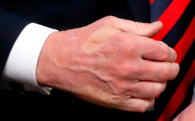 The outlines of Emmanuel Macron's fingers are clearly visible on Donald Trump's hand - REUTERS