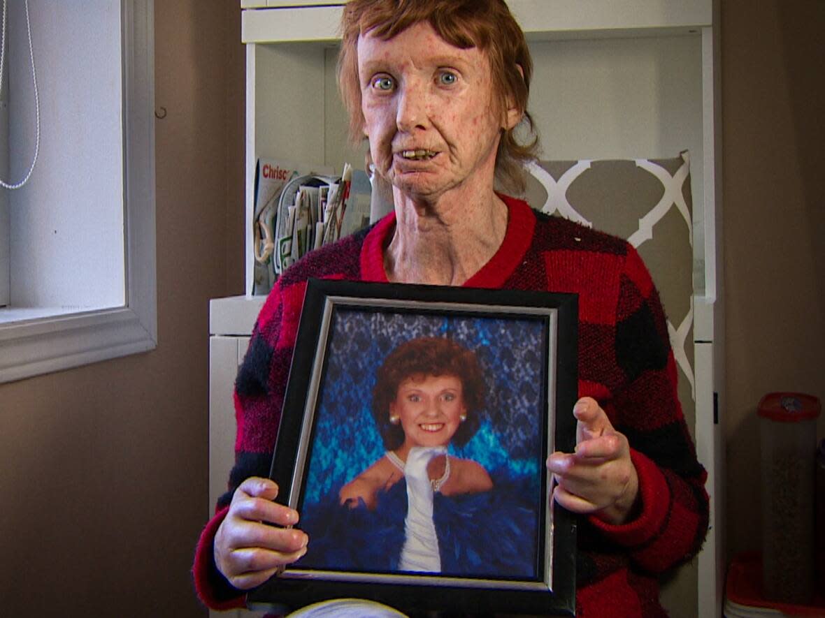 Bev Blanchette holds a photo taken during her 40th birthday. (Sakib Ibn Rashid Rhivu/CBC - image credit)