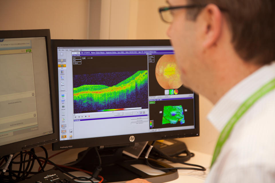 DeepMind has successfully developed a system that can analyze retinal scans