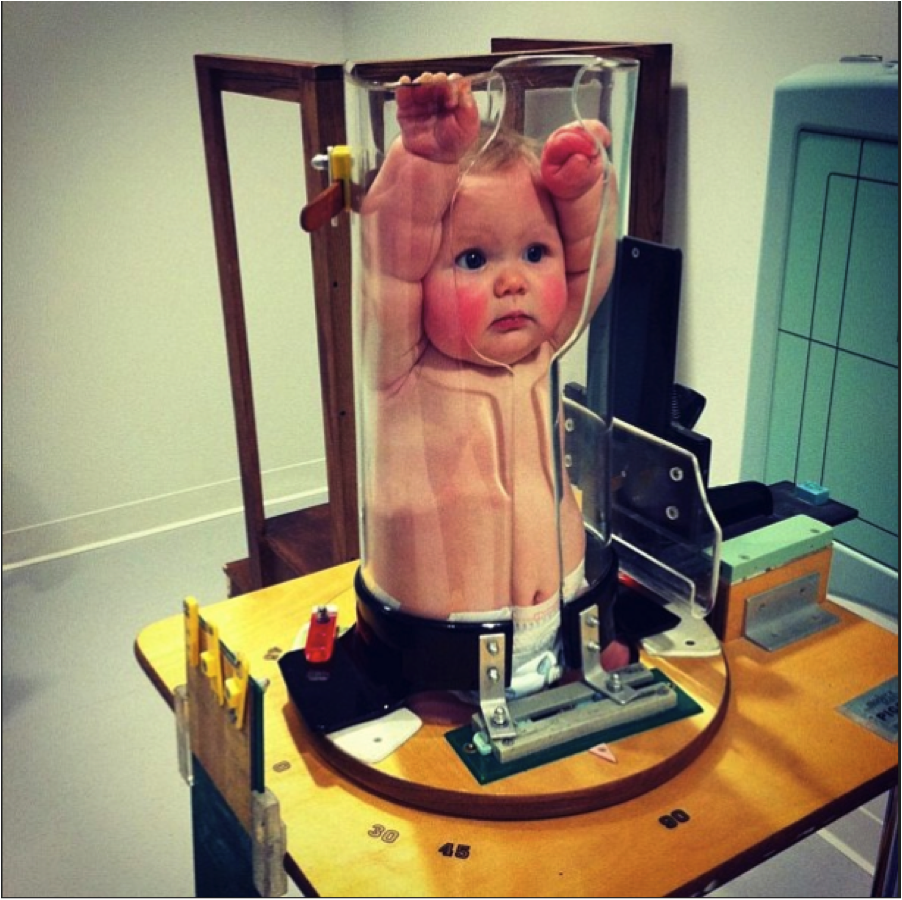 No, this is not a picture of a baby stuck in a giant test tube.