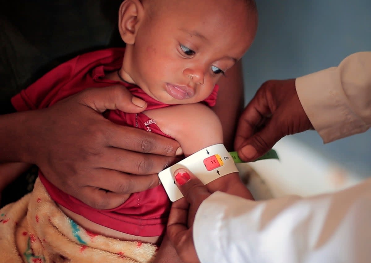 A nurse measures the arm circumference of Temesgen Muluhaw, eight months old, who is suffering from malnutrition, in Mai Mekden, northern Ethiopia (AP)