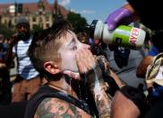 <p>“The boxed us in and started peppy spraying us,” said Mackenzie Marks of St. Louis, who her eyes washed out after being pepper spray protesting the not guilty verdict in the killing of Anthony Lamar Smith by former St. Louis police officer Jason Stockley on Friday, Sept. 15, 2017, near City Hall. (Photo: Laurie Skrivan/St. Louis Post-Dispatch via AP) </p>