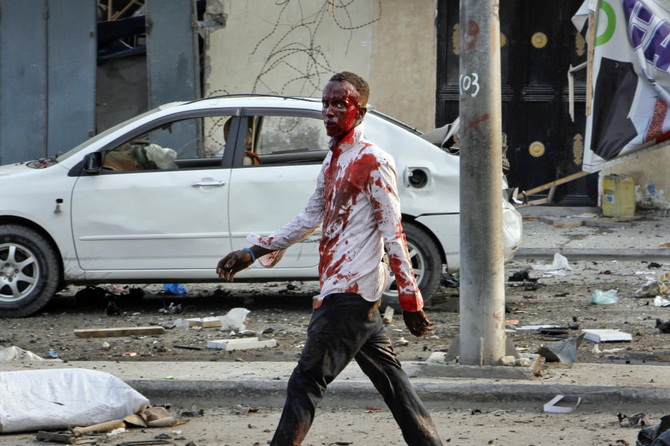 An injured civilian walks away from the scene after being wounded in a bomb blast near the Sahafi hotel in the capital Mogadishu, Somalia, Friday, Nov. 9, 2018. Three car bombs by Islamic extremists exploded outside the hotel, which is located across the street from the police Criminal Investigations Department, killing at least 10 people according to police. (AP Photo/Farah Abdi Warsameh)